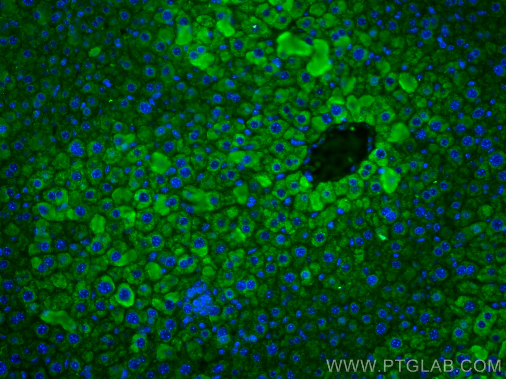 Immunofluorescence (IF) / fluorescent staining of mouse liver tissue using CYP2E1-Specific Monoclonal antibody (67263-1-Ig)