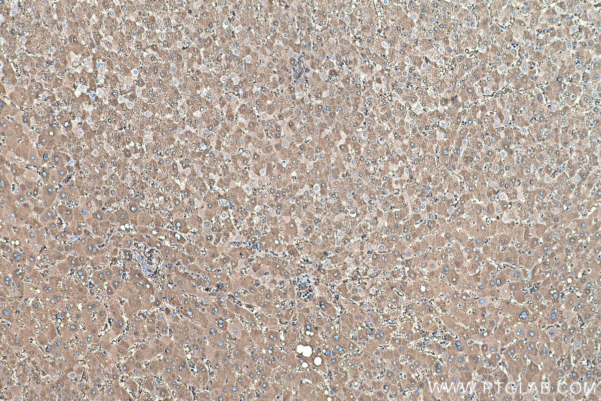 Immunohistochemistry (IHC) staining of human liver tissue using CYP2E1-Specific Monoclonal antibody (67263-1-Ig)