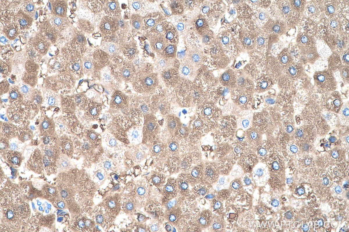 Immunohistochemistry (IHC) staining of human liver tissue using CYP2E1-Specific Monoclonal antibody (67263-1-Ig)