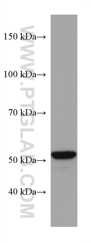 Western Blot (WB) analysis of rat liver tissue using CYP2E1-Specific Monoclonal antibody (67263-1-Ig)