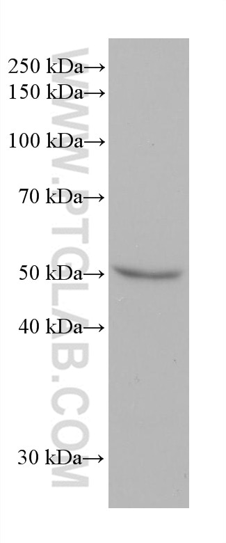 Western Blot (WB) analysis of HaCaT cells using CYP2E1-Specific Monoclonal antibody (67263-1-Ig)