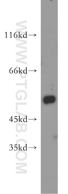 Western Blot (WB) analysis of mouse lung tissue using CYP2F1 Polyclonal antibody (21579-1-AP)