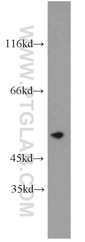 WB analysis of mouse lung using 21579-1-AP