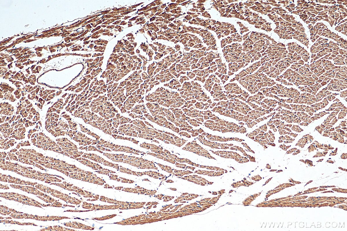 Immunohistochemistry (IHC) staining of mouse heart tissue using CYP2J2 Polyclonal antibody (13562-1-AP)