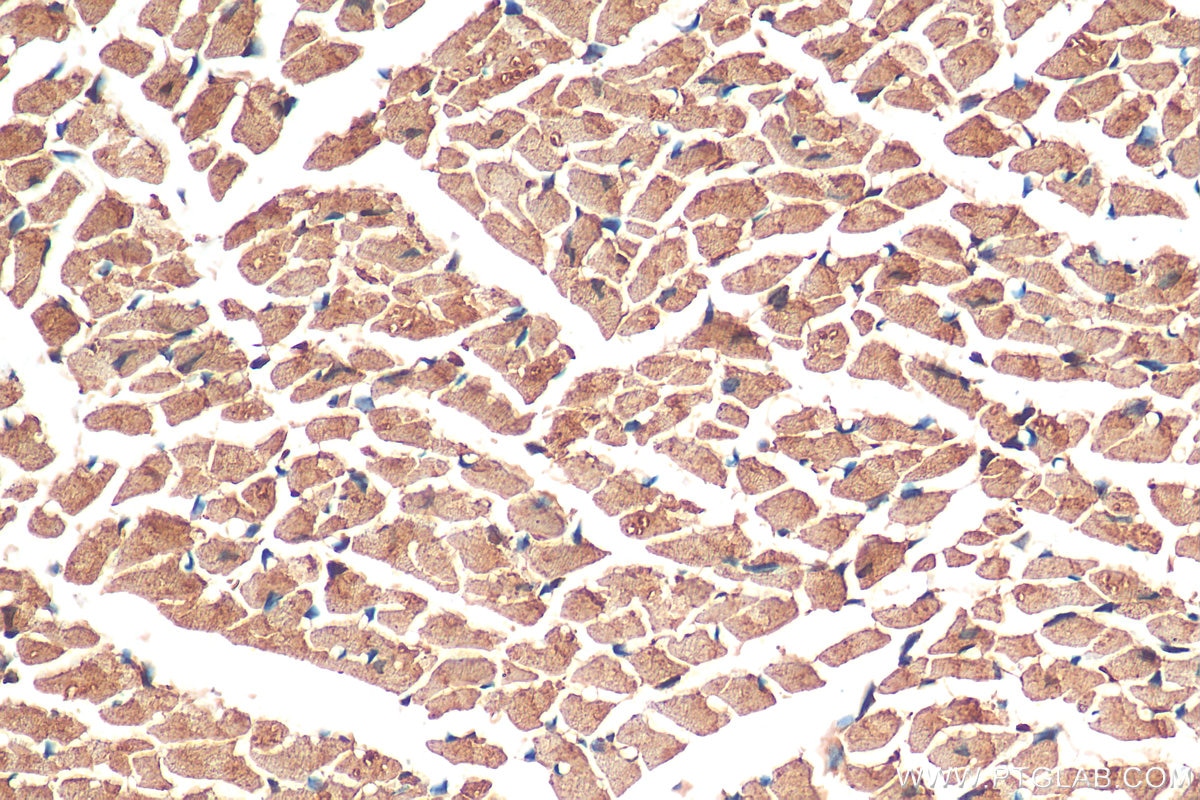 Immunohistochemistry (IHC) staining of mouse heart tissue using CYP2J2 Polyclonal antibody (13562-1-AP)