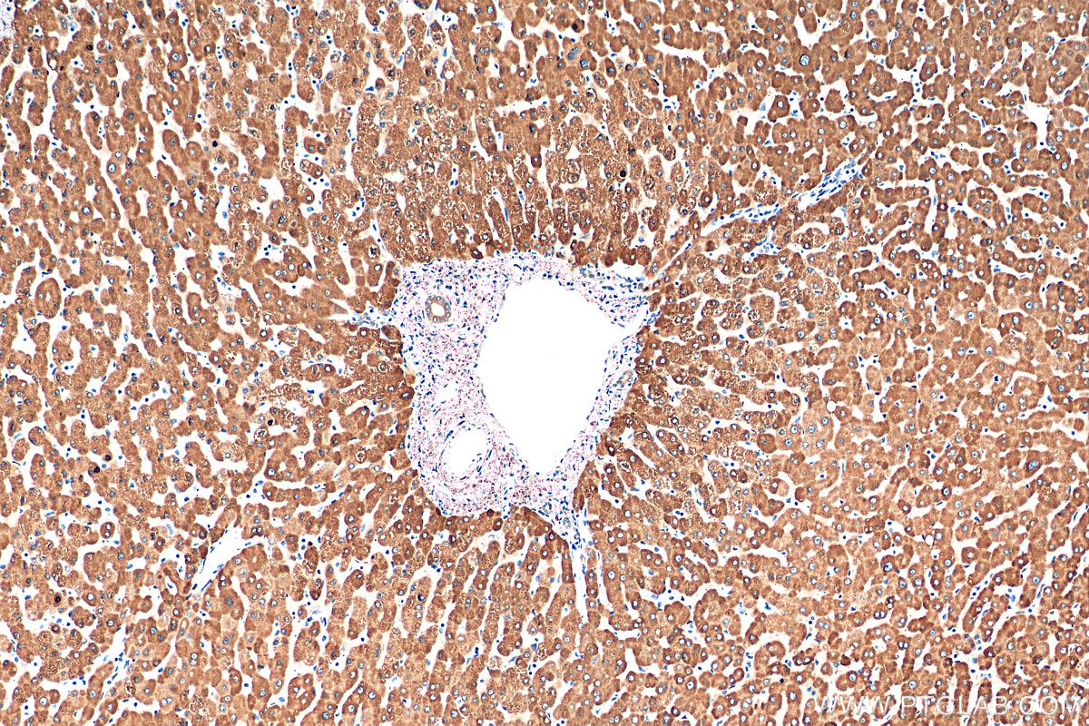 Immunohistochemistry (IHC) staining of human liver tissue using CYP2J2 Polyclonal antibody (13562-1-AP)