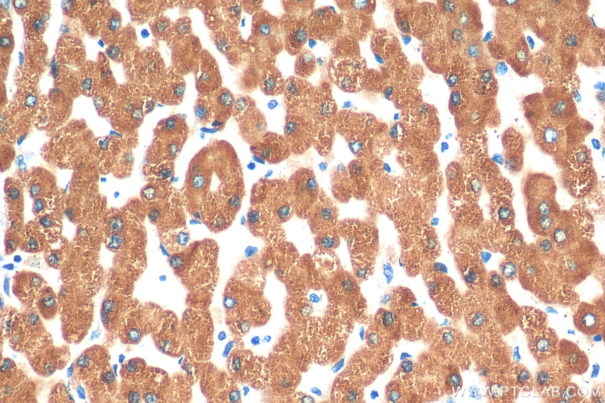 Immunohistochemistry (IHC) staining of human liver tissue using CYP2J2 Polyclonal antibody (13562-1-AP)