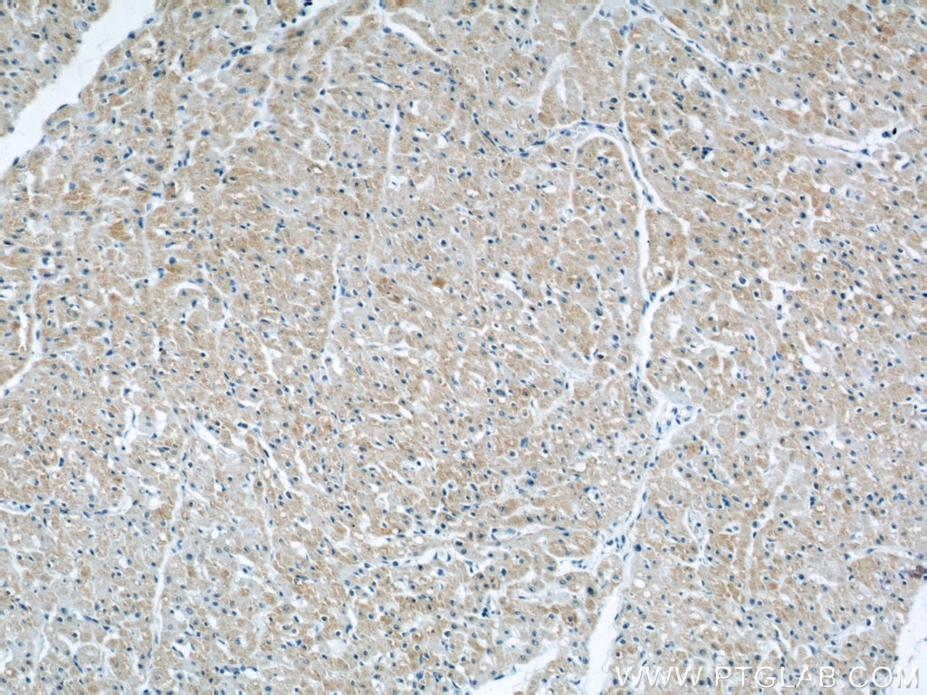 IHC staining of human heart using 13562-1-AP