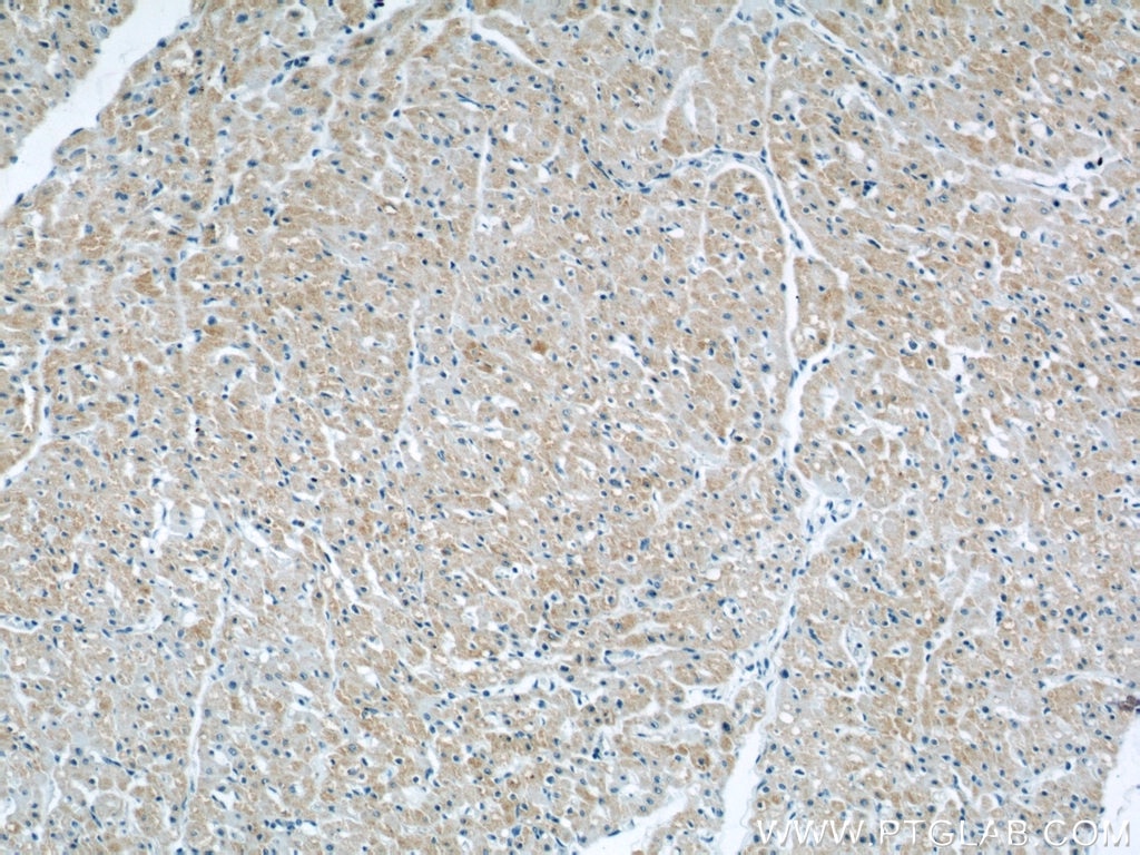 Immunohistochemistry (IHC) staining of human heart tissue using CYP2J2 Polyclonal antibody (13562-1-AP)