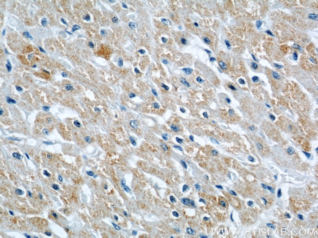 Immunohistochemistry (IHC) staining of human heart tissue using CYP2J2 Polyclonal antibody (13562-1-AP)