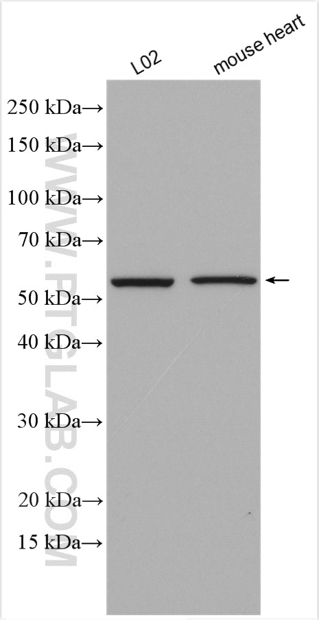 Western Blot (WB) analysis of various lysates using CYP2J2 Polyclonal antibody (13562-1-AP)