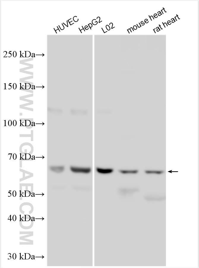 Western Blot (WB) analysis of various lysates using CYP2J2 Polyclonal antibody (13562-1-AP)