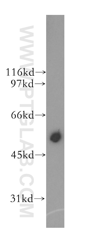 Western Blot (WB) analysis of mouse skeletal muscle tissue using CYP2J2 Polyclonal antibody (13562-1-AP)