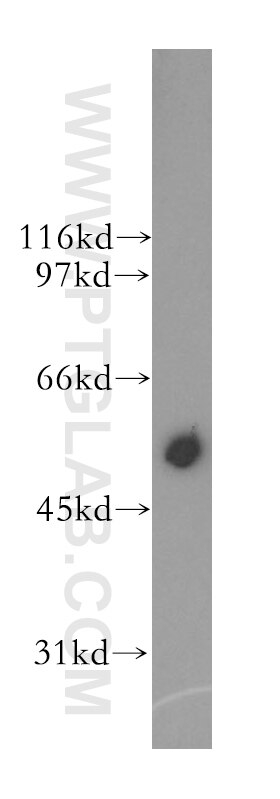 WB analysis of mouse skeletal muscle using 13562-1-AP