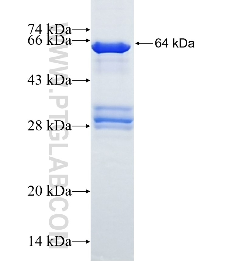 CYP2J2 fusion protein Ag4435 SDS-PAGE