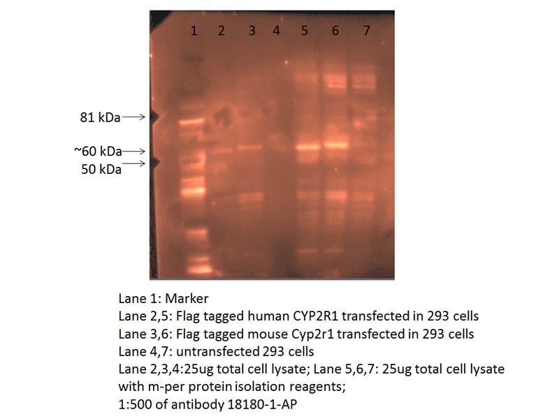 Western Blot (WB) analysis of transfected cells using CYP2R1 Polyclonal antibody (18180-1-AP)