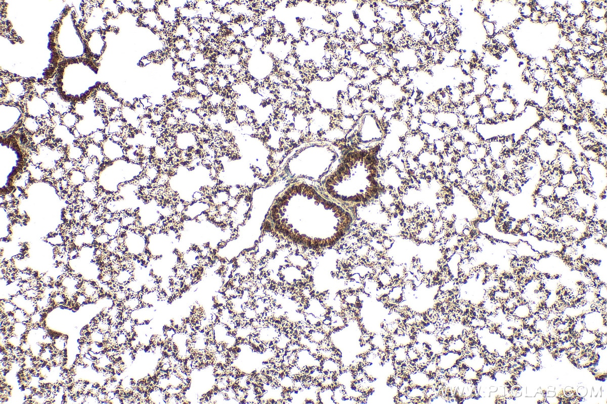 Immunohistochemistry (IHC) staining of mouse lung tissue using CYP2S1 Polyclonal antibody (13654-1-AP)