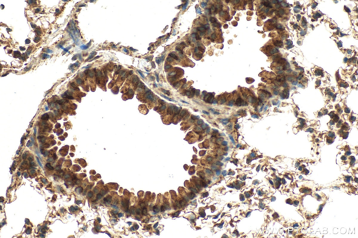 Immunohistochemistry (IHC) staining of mouse lung tissue using CYP2S1 Polyclonal antibody (13654-1-AP)
