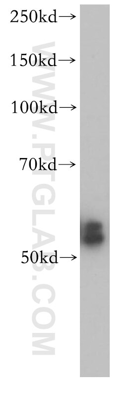 Western Blot (WB) analysis of mouse lung tissue using CYP2S1 Polyclonal antibody (13654-1-AP)