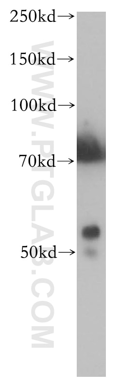 Western Blot (WB) analysis of mouse skin tissue using CYP2S1 Polyclonal antibody (13654-1-AP)