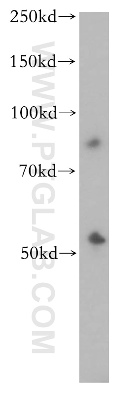 Western Blot (WB) analysis of mouse lung tissue using CYP2S1 Polyclonal antibody (13654-1-AP)