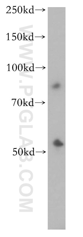 Western Blot (WB) analysis of mouse lung tissue using CYP2S1 Polyclonal antibody (13654-1-AP)