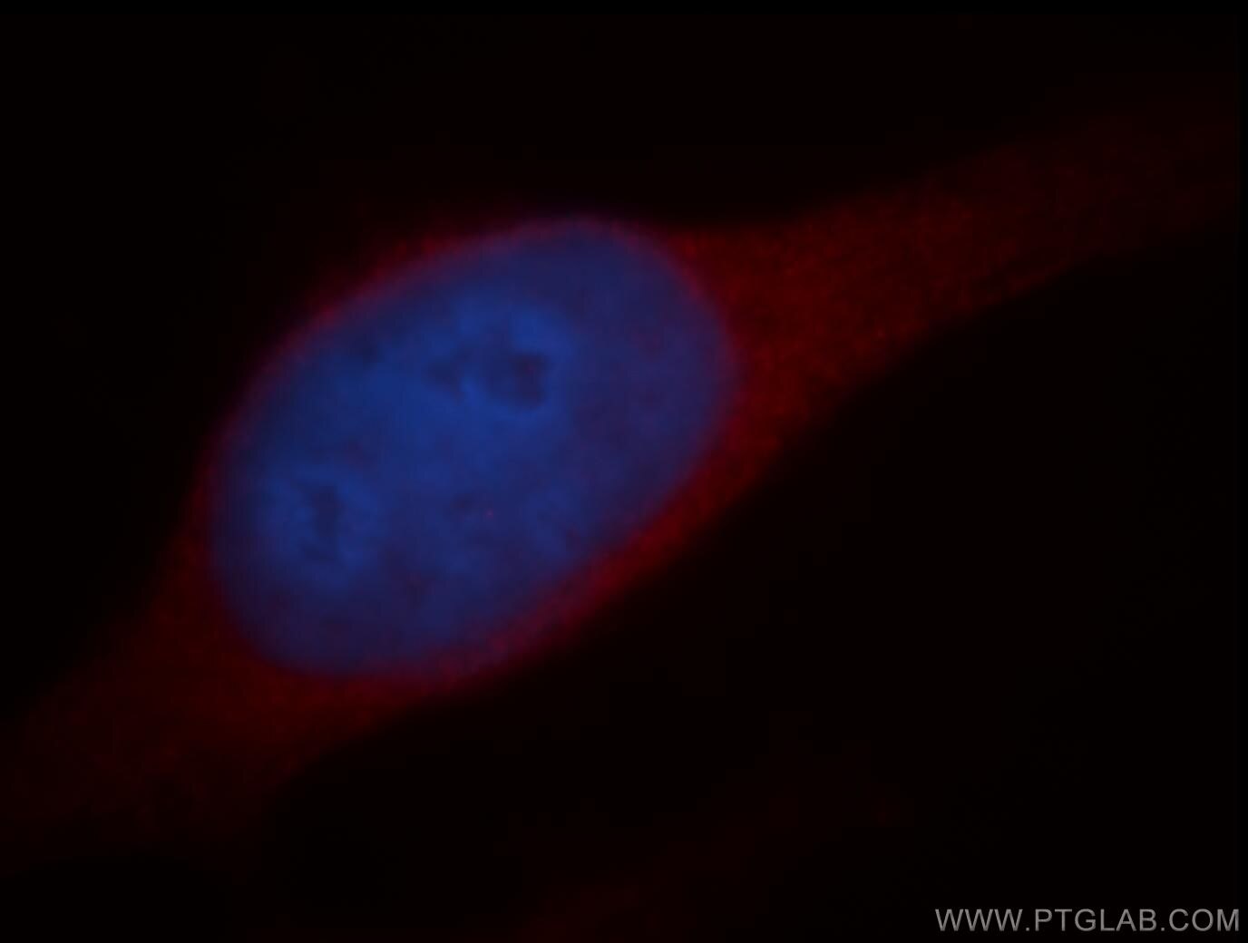 Immunofluorescence (IF) / fluorescent staining of HeLa cells using CYP2S1 Polyclonal antibody (19100-1-AP)
