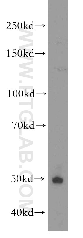 Western Blot (WB) analysis of mouse kidney tissue using CYP2S1 Polyclonal antibody (19100-1-AP)