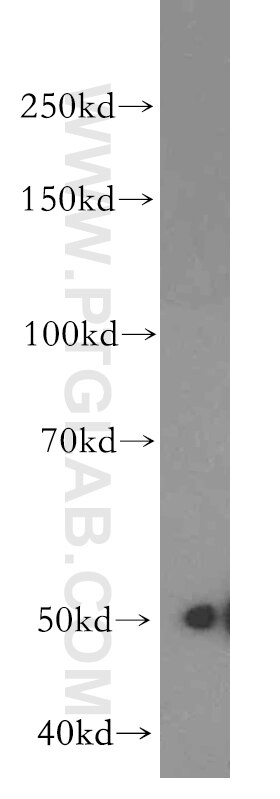 Western Blot (WB) analysis of COLO 320 cells using CYP2S1 Polyclonal antibody (19100-1-AP)