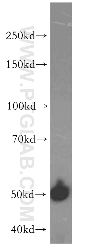 Western Blot (WB) analysis of COLO 320 cells using CYP2S1 Polyclonal antibody (19100-1-AP)