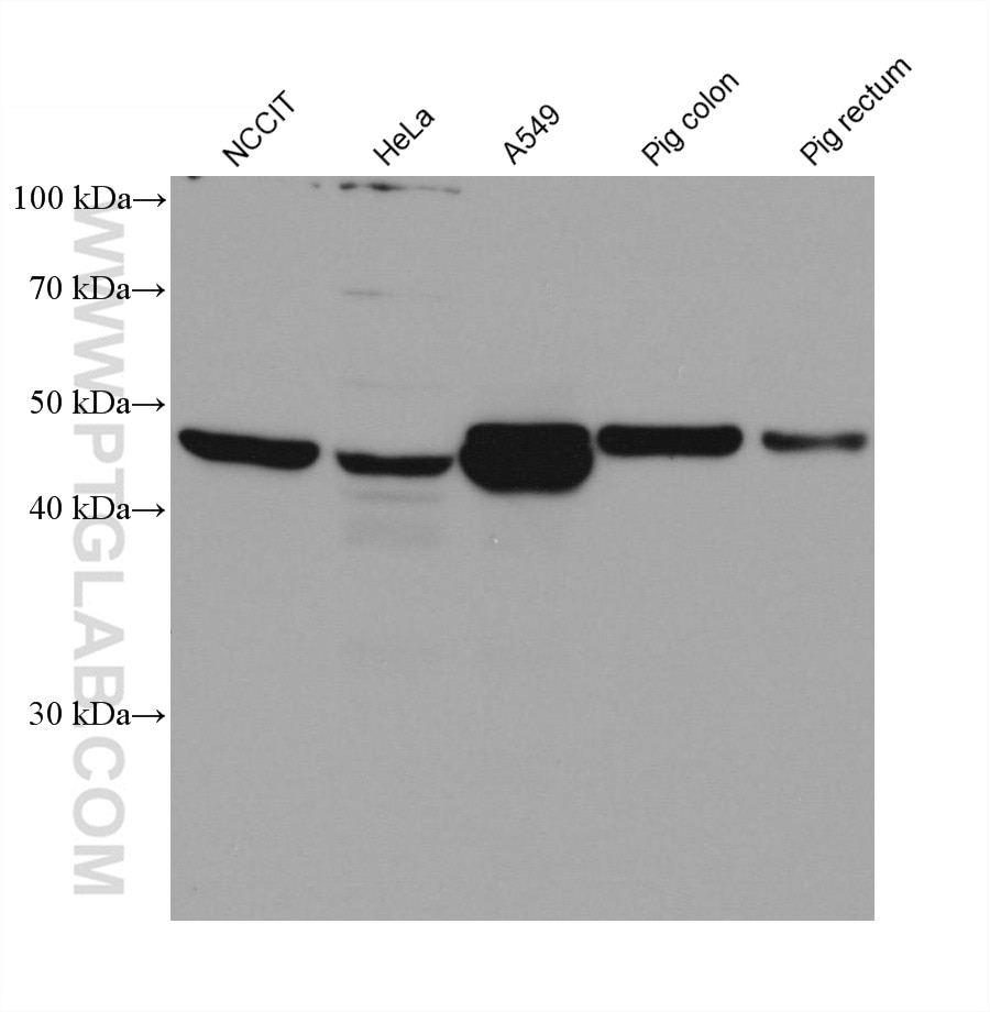 Western Blot (WB) analysis of various lysates using CYP2S1 Monoclonal antibody (68198-1-Ig)