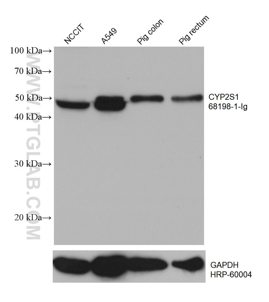 Western Blot (WB) analysis of various lysates using CYP2S1 Monoclonal antibody (68198-1-Ig)