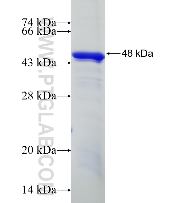 CYP2S1 fusion protein Ag4605 SDS-PAGE