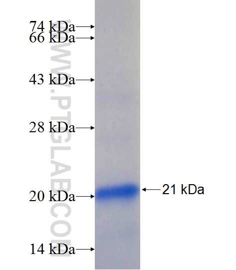 CYP2U1 fusion protein Ag24390 SDS-PAGE