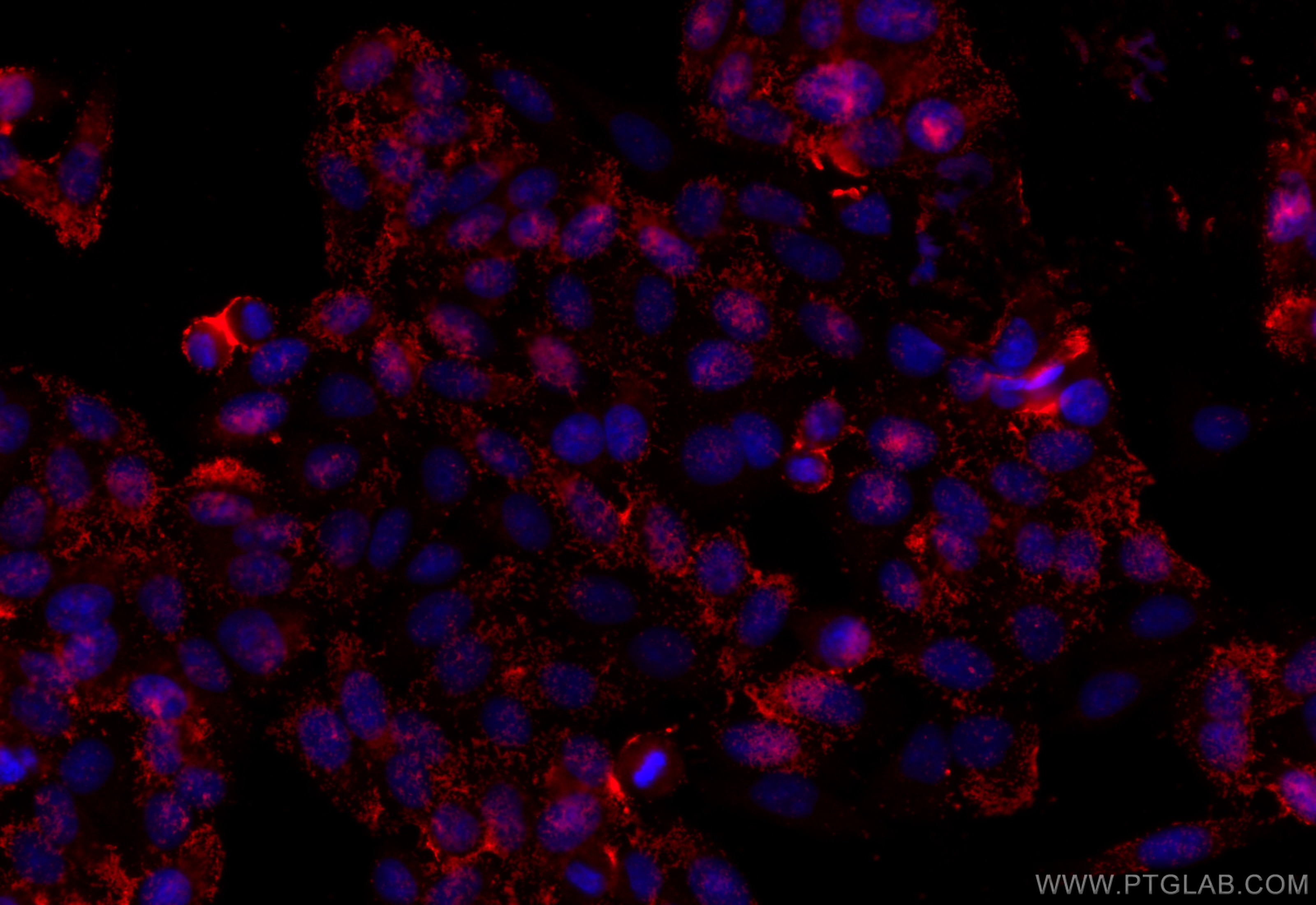 Immunofluorescence (IF) / fluorescent staining of HepG2 cells using CYP2W1 Polyclonal antibody (12904-1-AP)