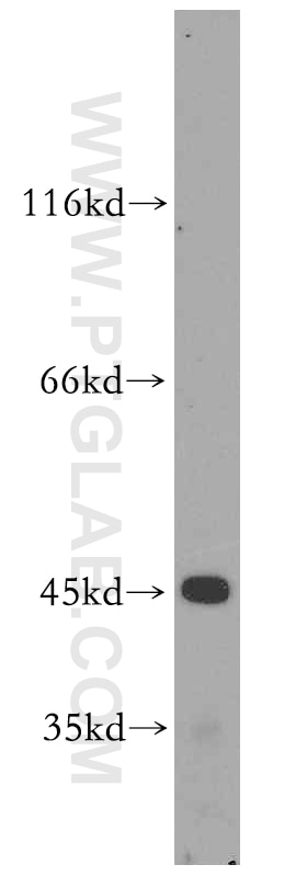 Western Blot (WB) analysis of HepG2 cells using CYP2W1 Polyclonal antibody (12904-1-AP)
