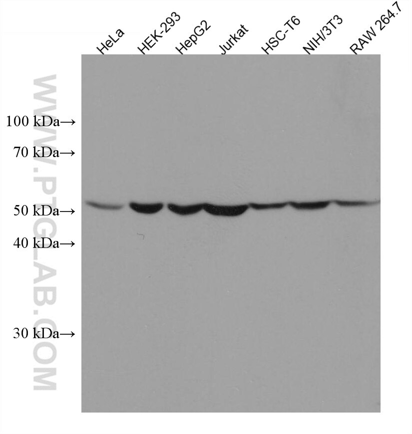 Western Blot (WB) analysis of various lysates using CYP2W1 Monoclonal antibody (67419-1-Ig)
