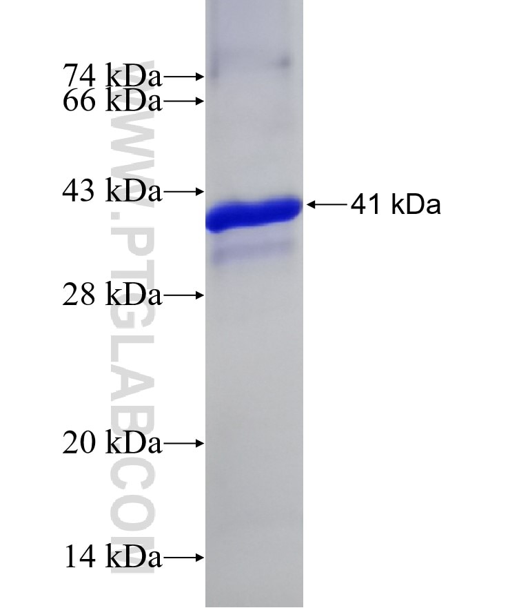 CYP2W1 fusion protein Ag29982 SDS-PAGE
