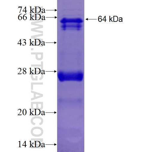 CYP2W1 fusion protein Ag3803 SDS-PAGE