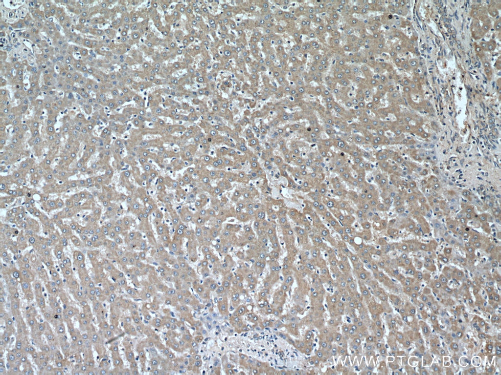 IHC staining of human liver using 16062-1-AP