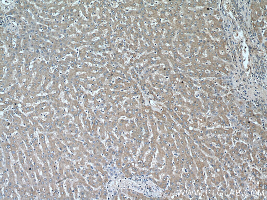 Immunohistochemistry (IHC) staining of human liver tissue using CYP39A1 Polyclonal antibody (16062-1-AP)