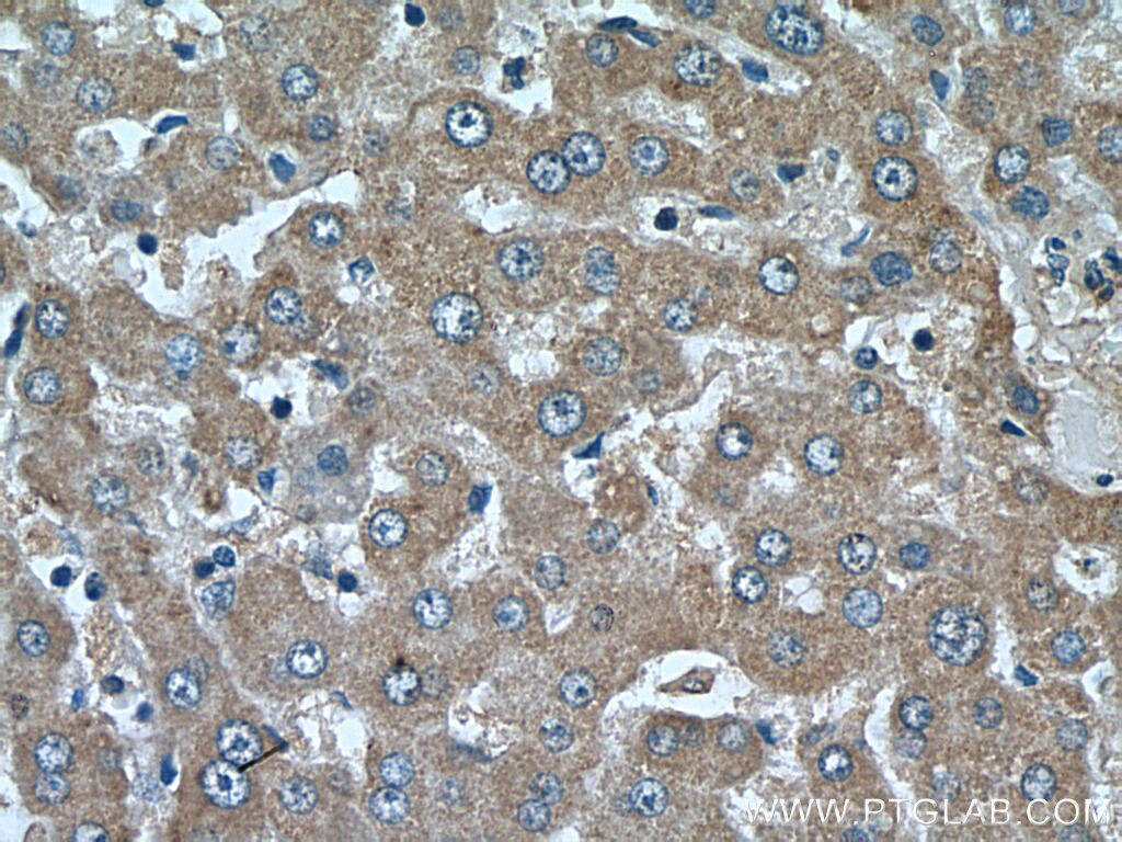 Immunohistochemistry (IHC) staining of human liver tissue using CYP39A1 Polyclonal antibody (16062-1-AP)