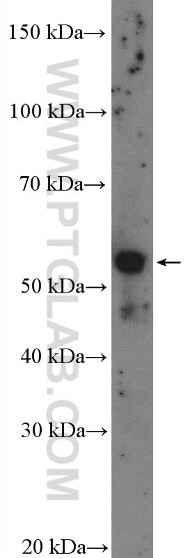 WB analysis of L02 using 16062-1-AP