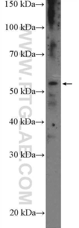 Western Blot (WB) analysis of SMMC-7721 cells using CYP39A1 Polyclonal antibody (16062-1-AP)