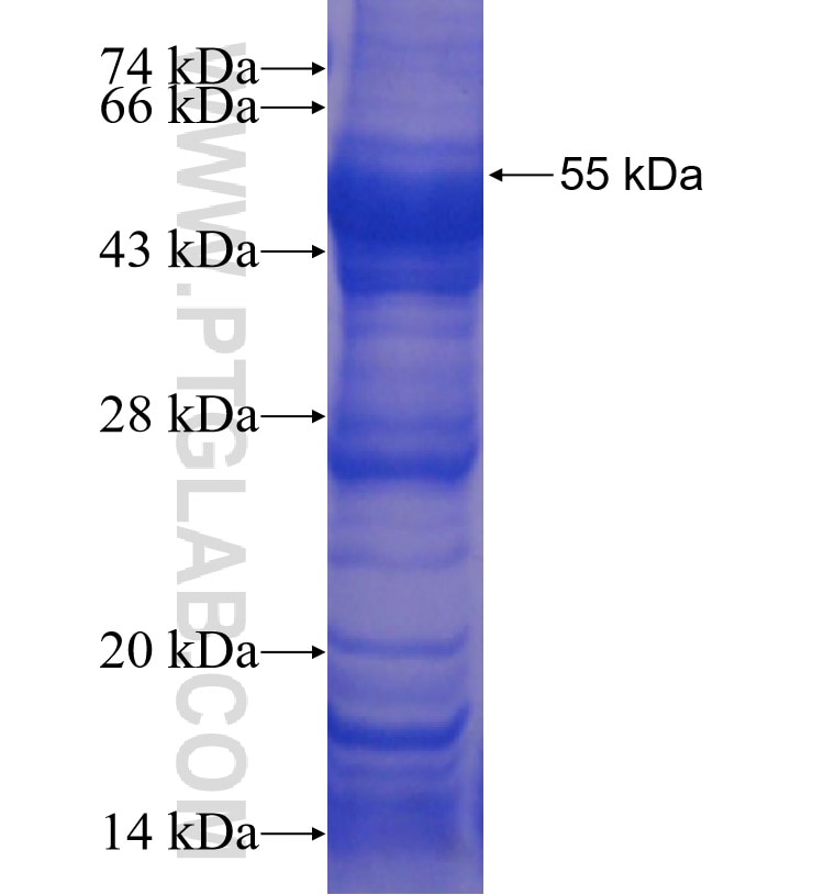 CYP39A1 fusion protein Ag8896 SDS-PAGE