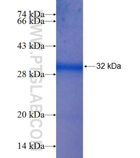 CYP39A1 fusion protein Ag9193 SDS-PAGE
