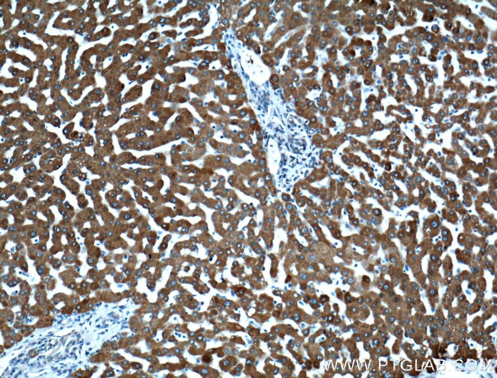 Immunohistochemistry (IHC) staining of human liver tissue using CYP3A4 Polyclonal antibody (18227-1-AP)