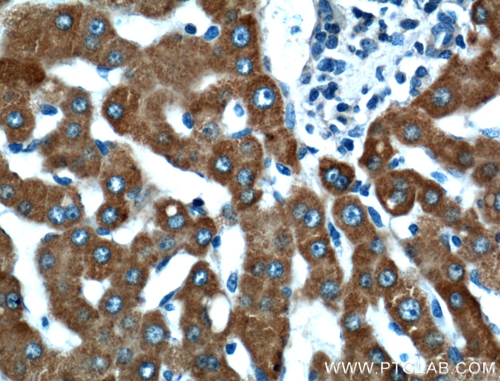 Immunohistochemistry (IHC) staining of human liver tissue using CYP3A4 Polyclonal antibody (18227-1-AP)