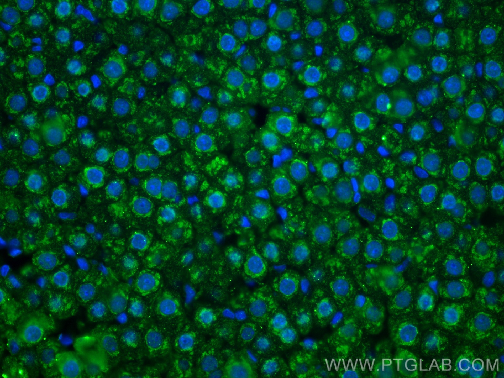 Immunofluorescence (IF) / fluorescent staining of rat liver tissue using CYP3A4 Monoclonal antibody (67110-1-Ig)