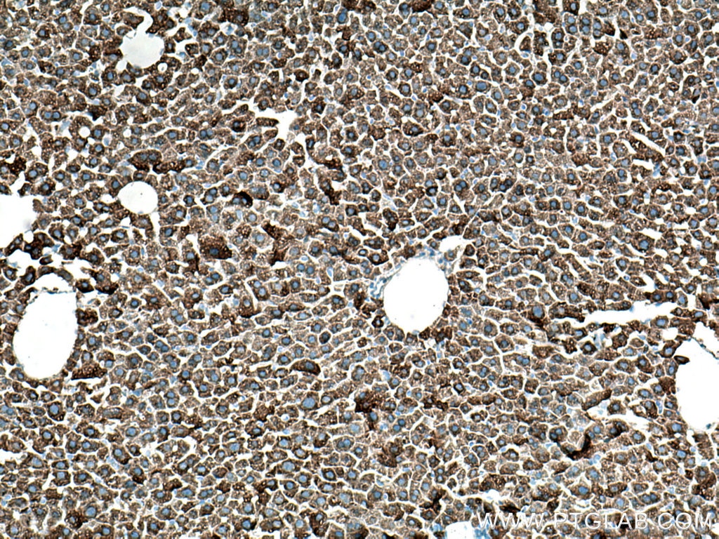 Immunohistochemistry (IHC) staining of mouse liver tissue using CYP3A4 Monoclonal antibody (67110-1-Ig)